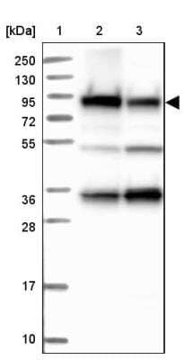 Western Blot: Glycogen Synthase Antibody [NBP2-34071]