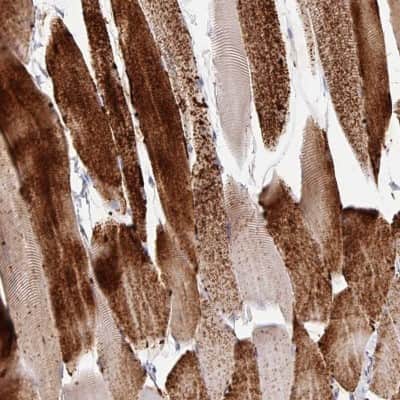 Immunohistochemistry-Paraffin: Glycogen phosphorylase, muscle form Antibody [NBP2-49209]