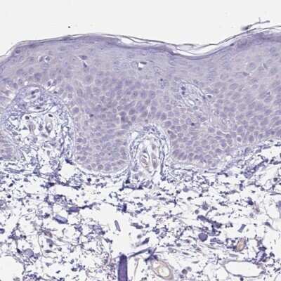 Immunohistochemistry-Paraffin: Glycogen phosphorylase, muscle form Antibody [NBP2-49209]