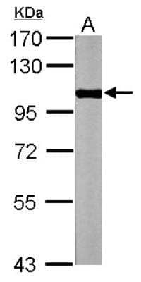 Western Blot: Glycogen phosphorylase, muscle form Antibody [NBP2-16689]
