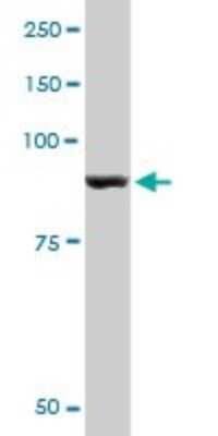 Western Blot: Glycogen phosphorylase, muscle form Antibody (2C4) [H00005837-M10]