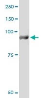 Western Blot: Glycogen phosphorylase, muscle form Antibody (2C4) [H00005837-M10]