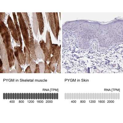 Immunohistochemistry-Paraffin: Glycogen phosphorylase, muscle form Antibody [NBP2-49209]