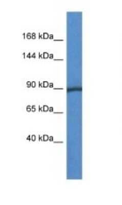 Western Blot: Glycogen phosphorylase, muscle form Antibody [NBP1-74149]