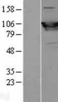 Western Blot: Glycogen phosphorylase, muscle form Overexpression Lysate [NBL1-15022]