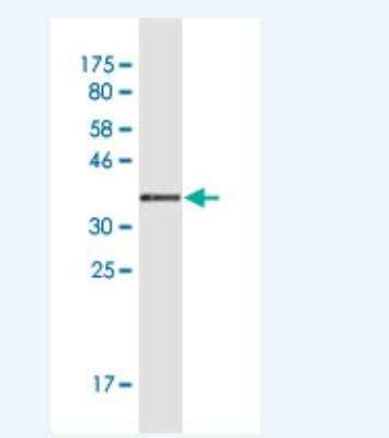 Western Blot: Glycogen synthase 2 Antibody (8H3) [H00002998-M06]