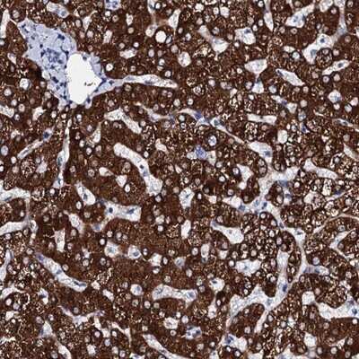 Immunohistochemistry-Paraffin: Glycogen synthase 2 Antibody [NBP1-91191]