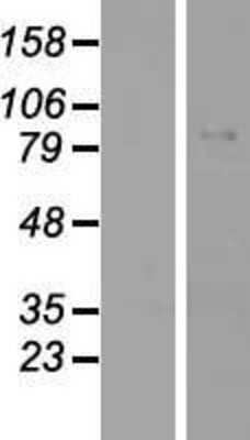 Western Blot: Glycogen synthase 2 Overexpression Lysate [NBP2-06498]