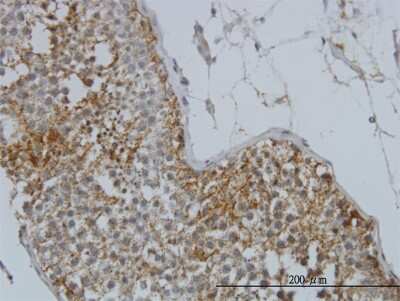 Immunohistochemistry-Paraffin: Glycogenin 1 Antibody (3B5) [H00002992-M07]