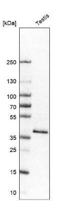 Western Blot: Glycogenin 1 Antibody [NBP1-89723]