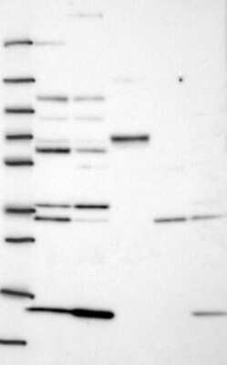 Western Blot: Glycogenin 1 Antibody [NBP3-17719]