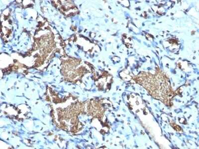 Immunohistochemistry-Paraffin: Glycophorin A Antibody (GYPA/1725R) - Azide and BSA Free [NBP2-54470]