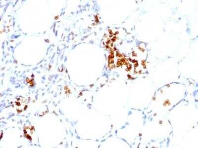 Immunohistochemistry-Paraffin: Glycophorin A Antibody (GYPA/280) - Azide and BSA Free [NBP2-47718]