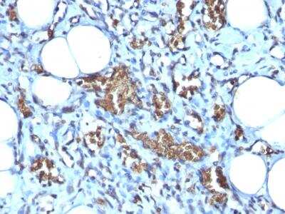 Immunohistochemistry-Paraffin: Glycophorin A Antibody (GYPA/280) - IHC-Prediluted [NBP2-48382]