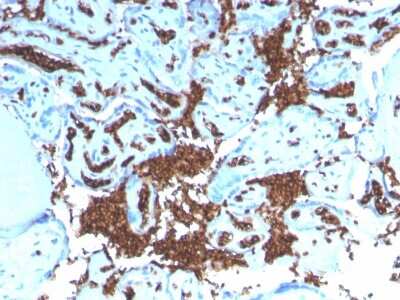 Immunohistochemistry-Paraffin: Glycophorin A Antibody (GYPA/3219R) [NBP3-07349]