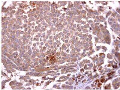 Immunohistochemistry-Paraffin: Glycophorin A Antibody [NBP2-16691]