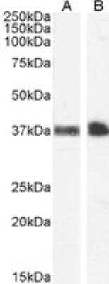 Western Blot: Glycophorin A Antibody [NB100-2428]