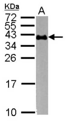 Western Blot: Glycophorin A Antibody [NBP2-16691]