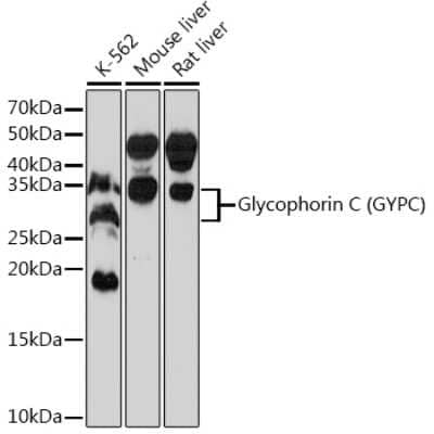 Western Blot: Glycophorin C Antibody (9K8U2) [NBP3-15385]