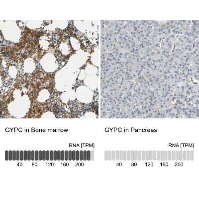 Immunohistochemistry-Paraffin: Glycophorin C Antibody [NBP1-84597]