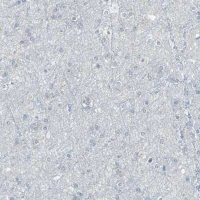 Immunohistochemistry-Paraffin: Glycophorin C Antibody [NBP1-84597]