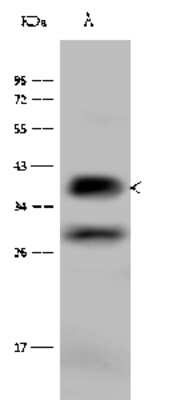 Western Blot: Glycophorin C Antibody [NBP2-97085]