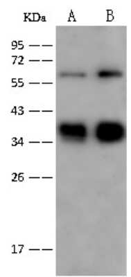 Western Blot: Glycophorin C Antibody [NBP2-97086]