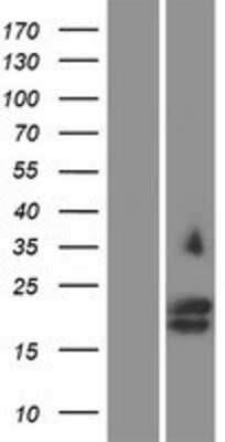 Western Blot: Glycophorin C Overexpression Lysate [NBP2-06999]