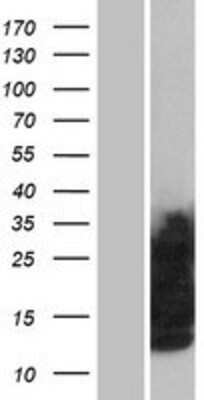 Western Blot: Glycophorin C Overexpression Lysate [NBP2-10799]