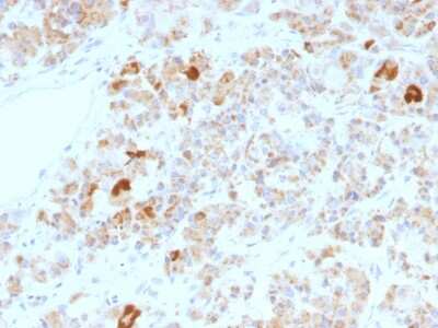 Immunohistochemistry-Paraffin: Chorionic Gonadotropin alpha Chain (hCG alpha) Antibody (LHa/756) - Azide and BSA Free [NBP2-54500]