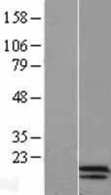 Western Blot: Chorionic Gonadotropin alpha Chain (hCG alpha) Overexpression Lysate [NBL1-09130]