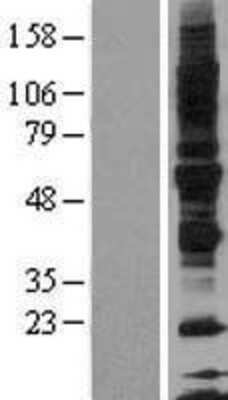 Western Blot: GPVI Overexpression Lysate [NBL1-11211]