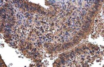 Immunohistochemistry-Paraffin: Glyoxalase I Antibody (266) [NBP2-43618]