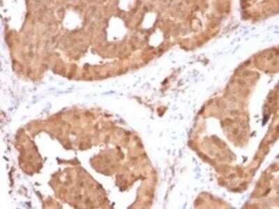 Immunohistochemistry-Paraffin: Glyoxalase I Antibody (CPTC-GLO1-1) [NBP3-07311]