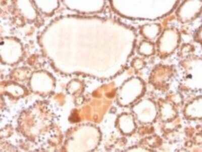Immunohistochemistry-Paraffin: Glyoxalase I Antibody (CPTC-GLO1-1) - Azide and BSA Free [NBP3-08555]