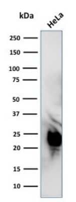 Western Blot: Glyoxalase I Antibody (CPTC-GLO1-1) [NBP3-07311]