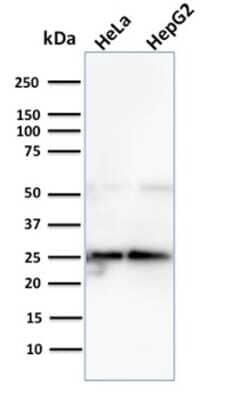 Western Blot: Glyoxalase I Antibody (CPTC-GLO1-3)Azide and BSA Free [NBP3-08556]