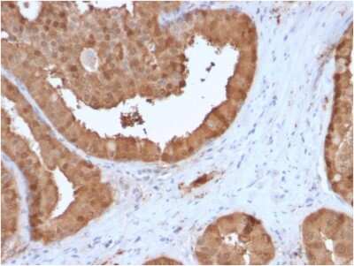 Immunohistochemistry-Paraffin: Glyoxalase I Antibody (CPTC-GLO1-3) [NBP3-07312]