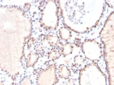 Immunohistochemistry-Paraffin: Glyoxalase I Antibody (CPTC-GLO1-3) [NBP3-07312]