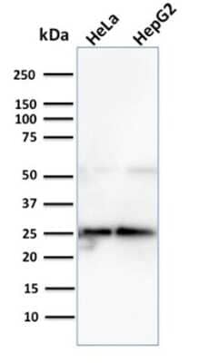 Western Blot: Glyoxalase I Antibody (CPTC-GLO1-3) [NBP3-07312]