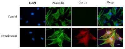 Immunocytochemistry/ Immunofluorescence: Glyoxalase I Antibody (Glo1a) - Azide and BSA Free [NBP2-80755]
