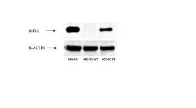 Western Blot: Glyoxalase I Antibody (Glo1a) [NBP1-19015]