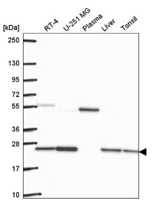 Western Blot: Glyoxalase I Antibody [NBP2-56695]