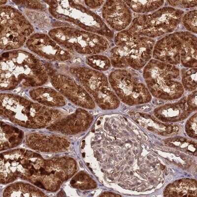 Immunohistochemistry: Glyoxalase II/HAGH Antibody [NBP2-38502]