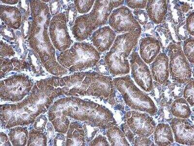 Immunohistochemistry-Paraffin: Glyoxalase II/HAGH Antibody [NBP1-33764]