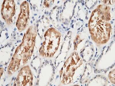Immunohistochemistry-Paraffin: Glyoxalase II/HAGH Antibody [NBP2-99941]