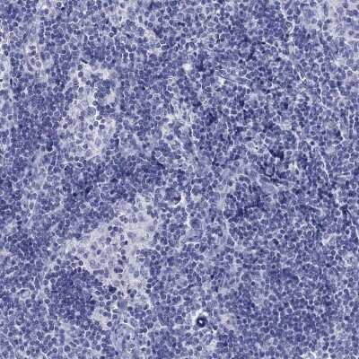 Immunohistochemistry-Paraffin: Glypican 1 Antibody [NBP3-17035]