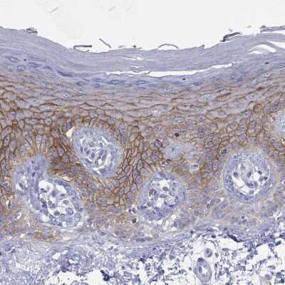 Immunohistochemistry-Paraffin: Glypican 1 Antibody [NBP3-17035]
