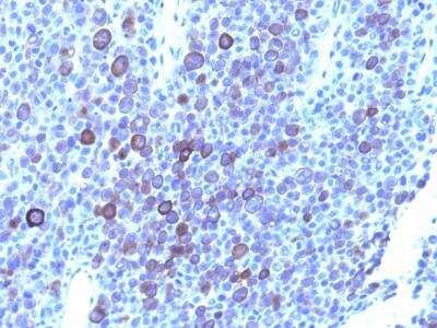 Immunohistochemistry-Paraffin: Glypican 3 Antibody (1G12 + GPC3/863) - IHC-Prediluted [NBP2-48418]