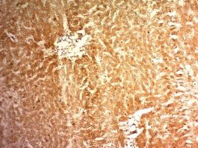 Immunohistochemistry-Paraffin: Glypican 3 Antibody (1G12) - Azide and BSA Free [NBP2-47760]